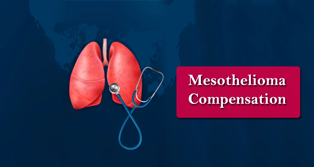 What is Mesothelioma and How to Get Mesothelioma Compensation ? Health